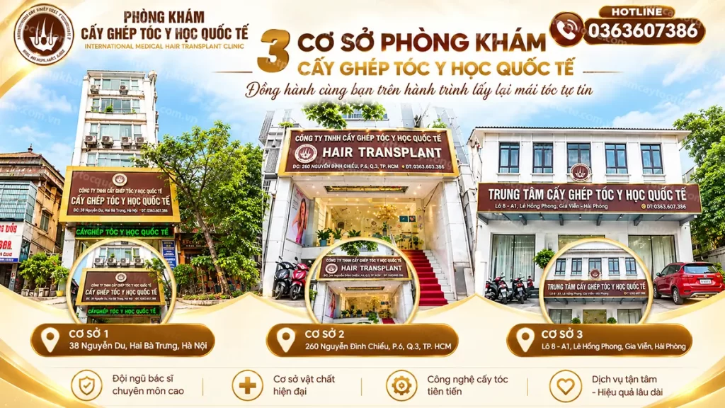 Địa chỉ chữa hói đầu uy tín tại Hà Nội, TP HCM, Hải Phòng
