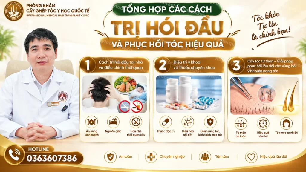 3 cách khắc phục hói đầu và phục hồi tóc hiệu quả hiện nay