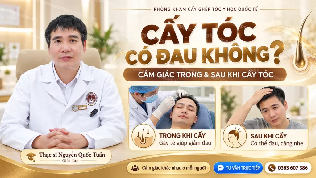 Bác sĩ giải đáp cấy tóc có đau không