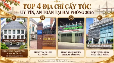 Top 4 Địa Chỉ Cấy Tóc Uy Tín, An Toàn Tại Hải Phòng 2026