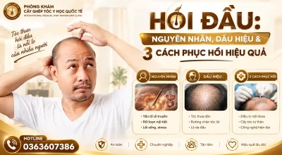 Hói Đầu: Nguyên Nhân, Dấu Hiệu & 3 Cách Phục Hồi Hiệu Quả