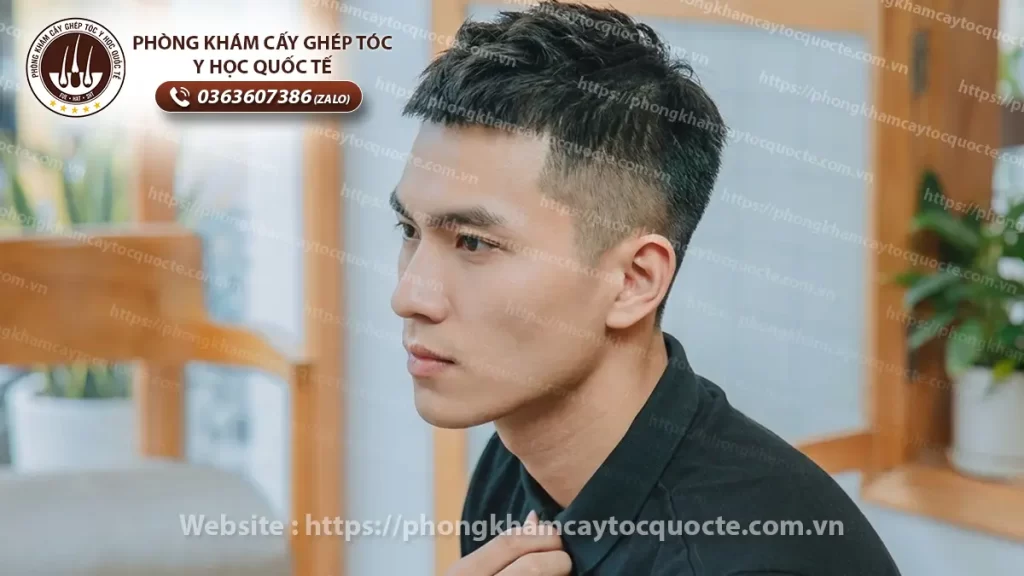 Kiểu tóc Tóc French Crop, Short Quiff giúp nam giới che khuyết điểm hói chữ M