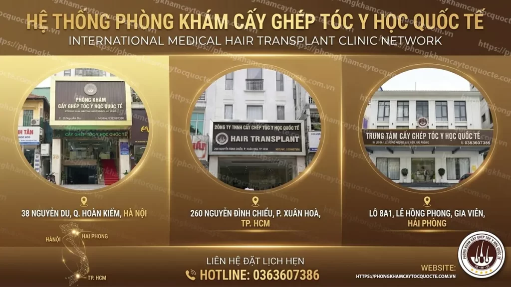 Phòng khám cấy ghép tóc y học quốc tế