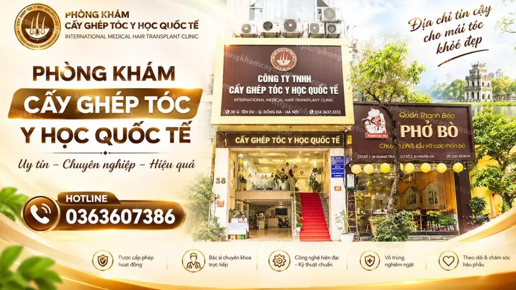 Phòng khám cấy ghép tóc quốc tế chi nhánh Hà Nội